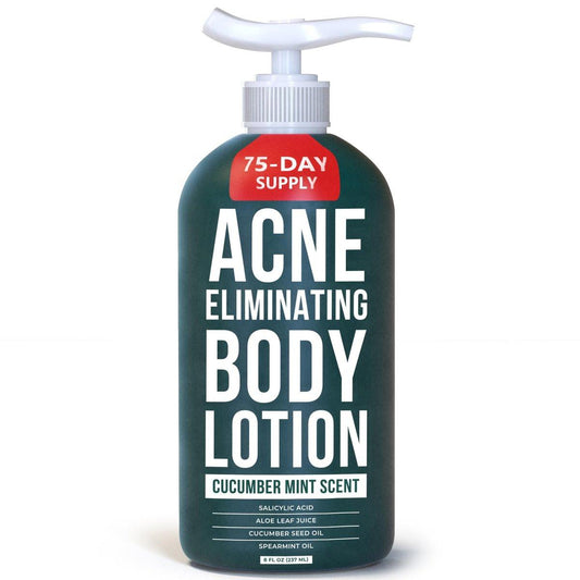 TreeActiv Akne-Bekämpfende Körperlotion 236 ml | Klärt Körper-, Rücken-, Po- und Schulterakne | Anti-Akne-Feuchtigkeitscreme | Verhindert zukünftige Ausbrüche | Duft nach Gurke und Minze