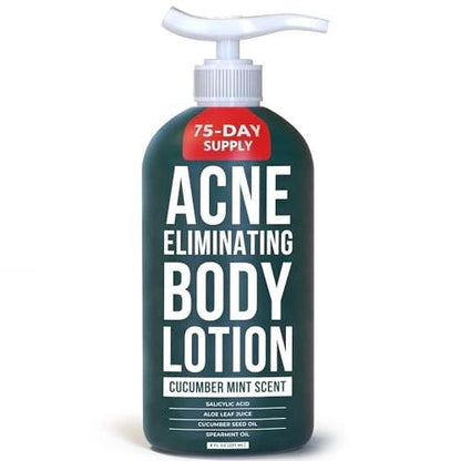 TreeActiv Akne-Bekämpfende Körperlotion 236 ml | Klärt Körper-, Rücken-, Po- und Schulterakne | Anti-Akne-Feuchtigkeitscreme | Verhindert zukünftige Ausbrüche | Duft nach Gurke und Minze