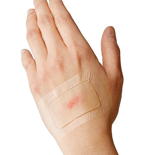 Curad Soothe & Cool Kühlende Brandwundenpflaster, sofortige Kühlung, verschiedene Größen, 8 Stück