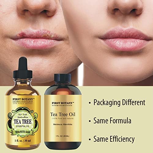 100% reines australisches Teebaumöl von First Botany – 30 ml mit hohem Terpinen-Gehalt zur Bekämpfung von Akne, Nagelproblemen und Schuppen