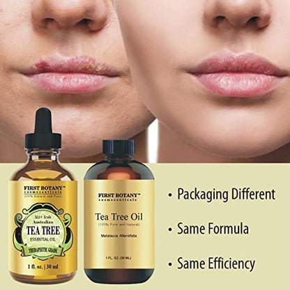 100% reines australisches Teebaumöl von First Botany – 30 ml mit hohem Terpinen-Gehalt zur Bekämpfung von Akne, Nagelproblemen und Schuppen