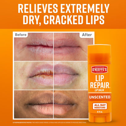 O'Keeffe's Lip Repair Unscented Lippenbalsam für trockene, rissige Lippen – 3er-Pack – Feuchtigkeitsspender für sehr trockene Lippen