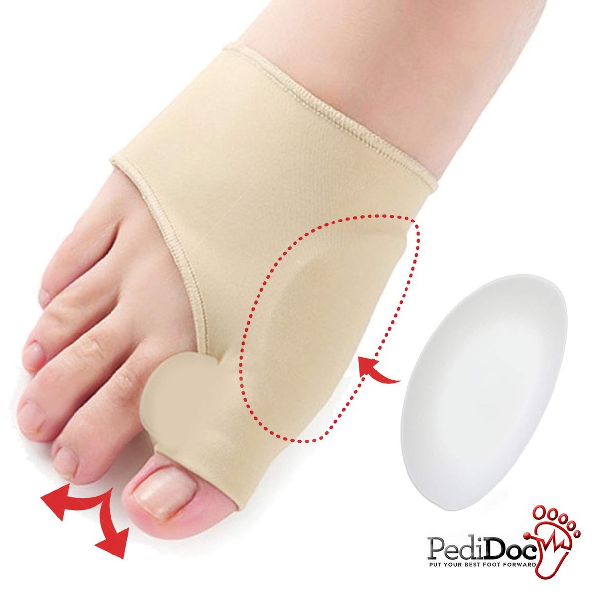 PediDocTM Zehenkorrektor – Ballenzeh Polster, Zehenstrecker mit Gel Zehenspreizer – Hallux Valgus Korrektur, Großzehenausrichtung