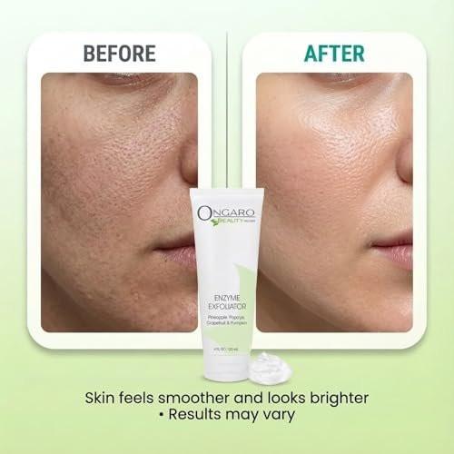 Ongaro Beauty Bio-Gesichtspeeling – Natürliches Gesichtspeeling & Enzympeeling für empfindliche Haut – Gesichtspeeling für Frauen & Männer – Reinigt Akne & befreit verstopfte Poren – Glättet & hellt auf – 118 ml