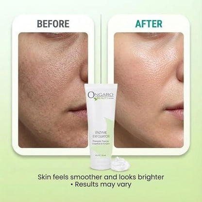 Ongaro Beauty Bio-Gesichtspeeling – Natürliches Gesichtspeeling & Enzympeeling für empfindliche Haut – Gesichtspeeling für Frauen & Männer – Reinigt Akne & befreit verstopfte Poren – Glättet & hellt auf – 118 ml