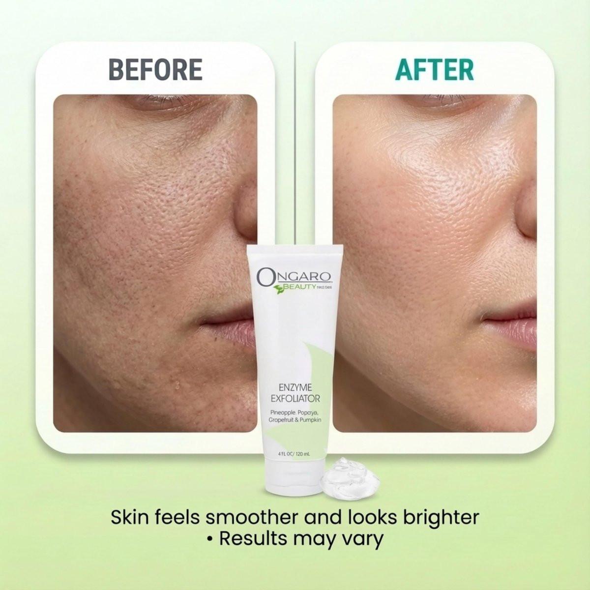 Ongaro Beauty Bio-Gesichtspeeling – Natürliches Gesichtspeeling & Enzympeeling für empfindliche Haut – Gesichtspeeling für Frauen & Männer – Reinigt Akne & befreit verstopfte Poren – Glättet & hellt auf – 118 ml