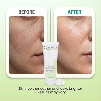 Ongaro Beauty Bio-Gesichtspeeling – Natürliches Gesichtspeeling & Enzympeeling für empfindliche Haut – Gesichtspeeling für Frauen & Männer – Reinigt Akne & befreit verstopfte Poren – Glättet & hellt auf – 118 ml