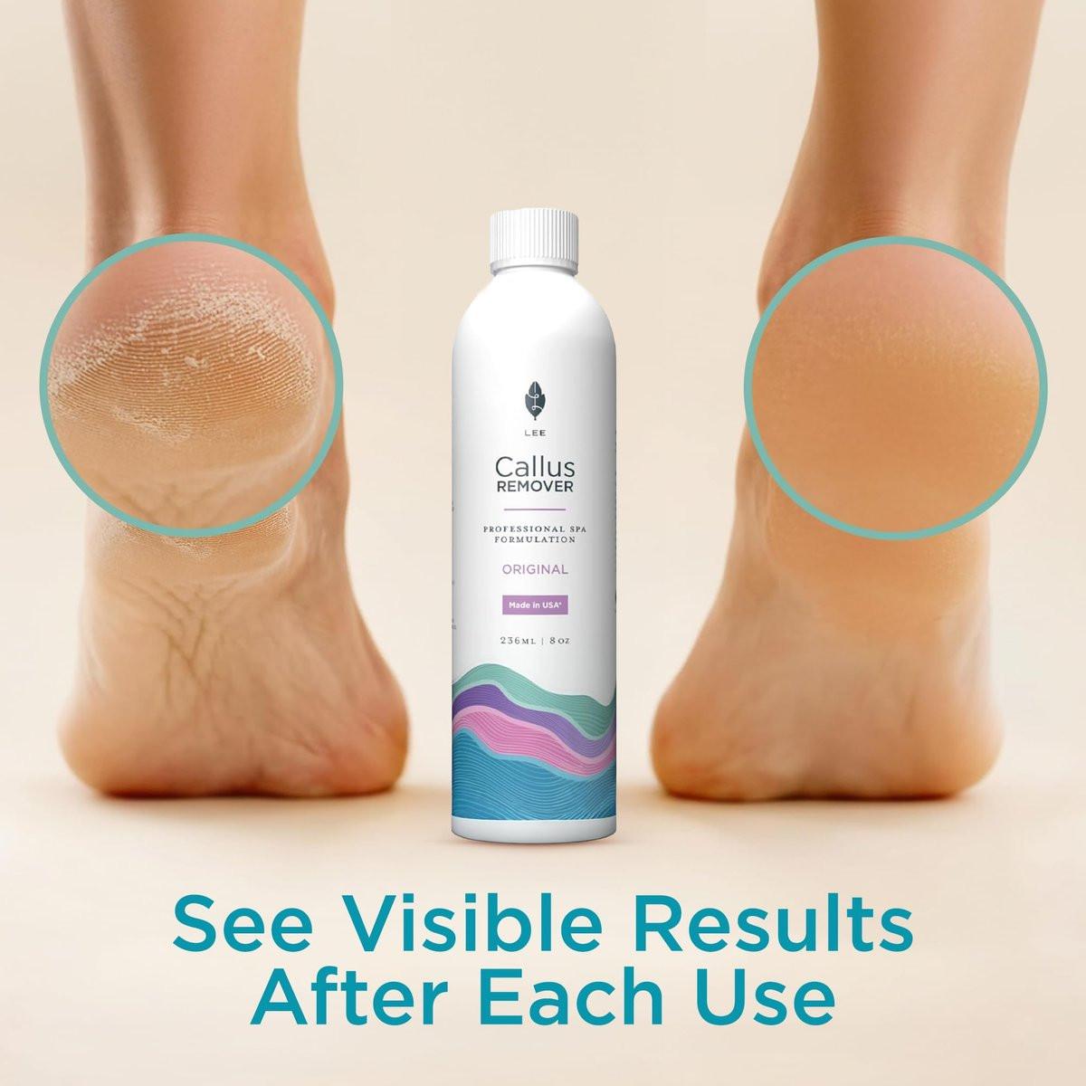 Lee Beauty Professional Gel Callus Entferner für Füße 237ml - Original schnell wirkende Formel, extra stark gegen rissige Fersen & abgestorbene Haut (1er-Pack)