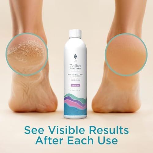 Lee Beauty Professional Gel Callus Entferner für Füße 237ml - Original schnell wirkende Formel, extra stark gegen rissige Fersen & abgestorbene Haut (1er-Pack)