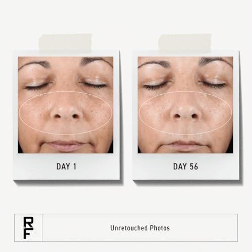 Rodan + Fields Active Hydration Serum | 30 ml | Feuchtigkeitsserum mit Glycerin und Hyaluronsäure
