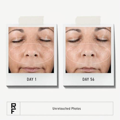 Rodan + Fields Active Hydration Serum | 30 ml | Feuchtigkeitsserum mit Glycerin und Hyaluronsäure