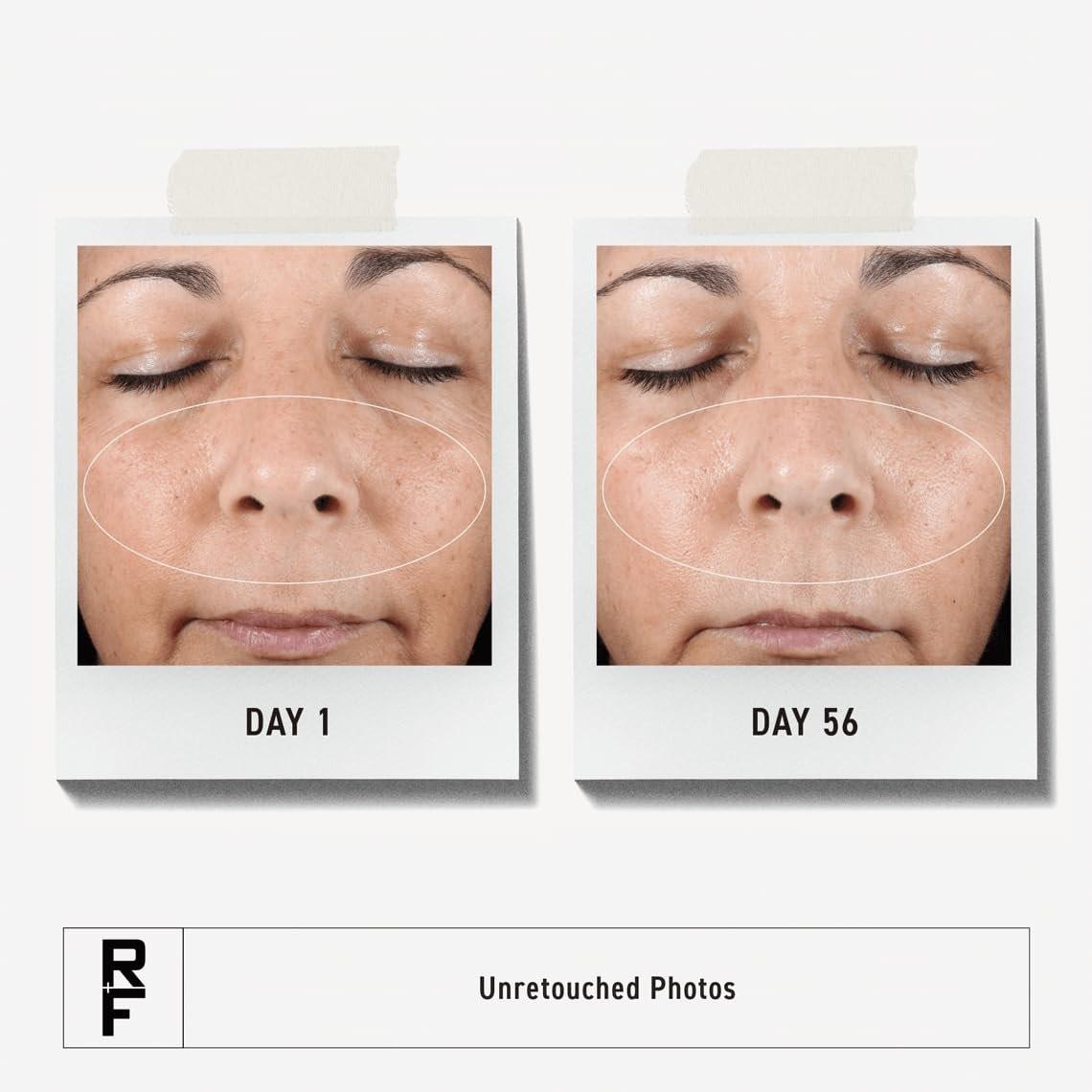 Rodan + Fields Active Hydration Serum | 30 ml | Feuchtigkeitsserum mit Glycerin und Hyaluronsäure