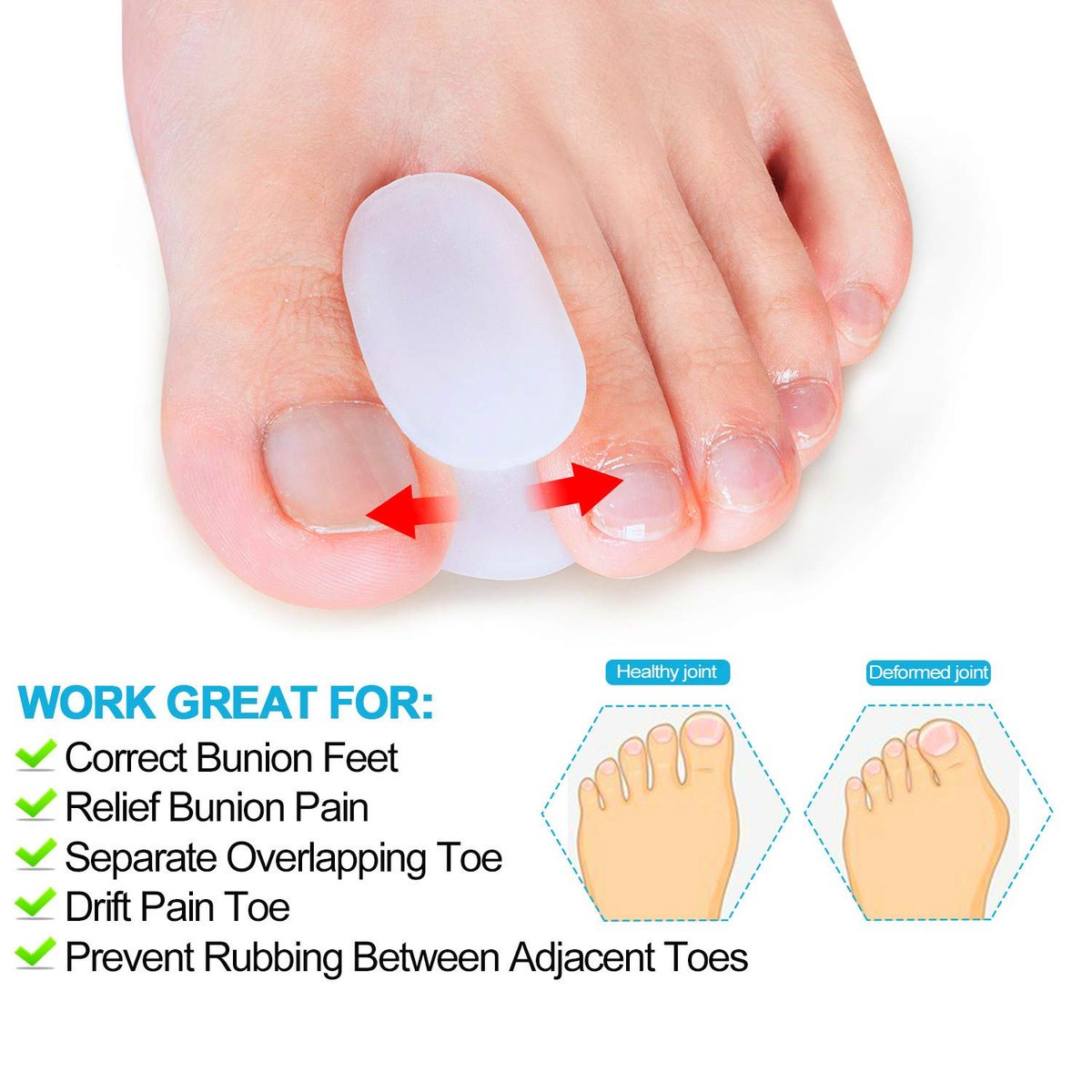 Povihome 10er Pack Gel Zehenspreizer & Ballenzehenkorrektur (0,3'' Dick) – Orthopädische Hilfsmittel für Ballenzehen, überlappende Zehen, Schmerzlinderung – Größe S