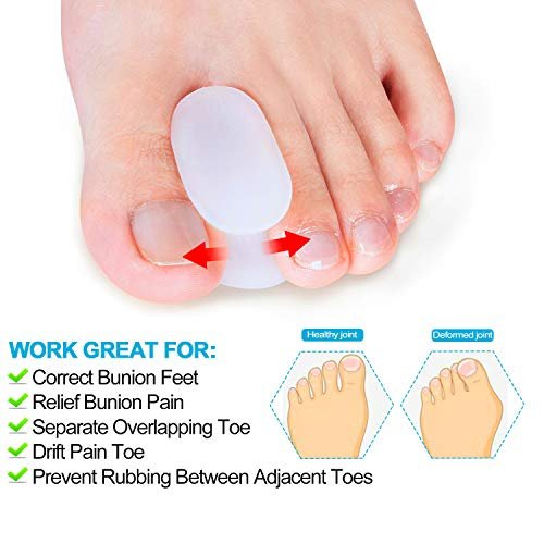 Povihome 10er Pack Gel Zehenspreizer & Ballenzehenkorrektur (0,3'' Dick) – Orthopädische Hilfsmittel für Ballenzehen, überlappende Zehen, Schmerzlinderung – Größe S