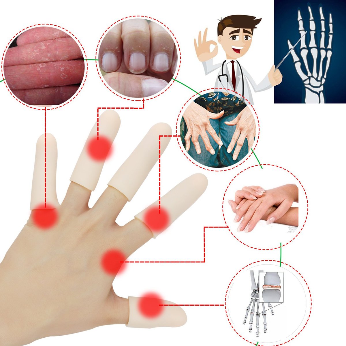 Gel-Fingerlinge, Fingerprotektor-Set (14 Stück) – Neue Material-Fingerhülsen gegen Triggerfinger, Handekzeme, rissige Finger, Fingerarthritis und mehr (10 lange + 4 kurze)