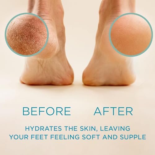 Lee Beauty Professional 8oz Gel Callus Entferner für Füße mit Raspel-Fußfeile - Original schnell wirkende Formel, extra stark gegen rissige Fersen und abgestorbene Haut (1er Pack)