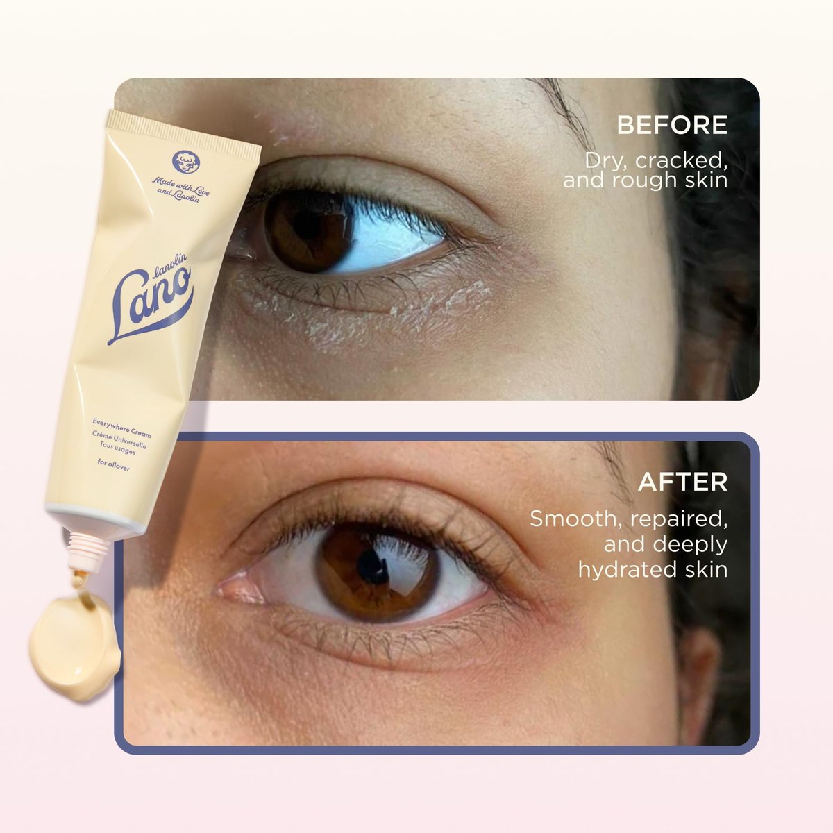 Lanolips Everywhere Cream – Ultra-feuchtigkeitsspendende Vitamin E & Lanolin Creme für Körper und Gesicht – Trockene, rissige Hautpflege für Kinder und Babys (85 ml / 2,9 oz)