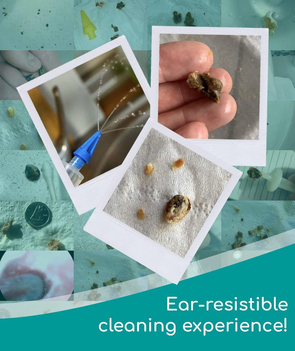 Medi Grade Ohrenspritze Ohrenschmalzentferner mit 3 Quad-Stream-Düsen – Wasserbewässerung Ohrreiniger für verbesserte Hörklarheit und Gehörhygiene – Ohrenspritzen-Set Ohrenschmalz-Entferner-Werkzeug