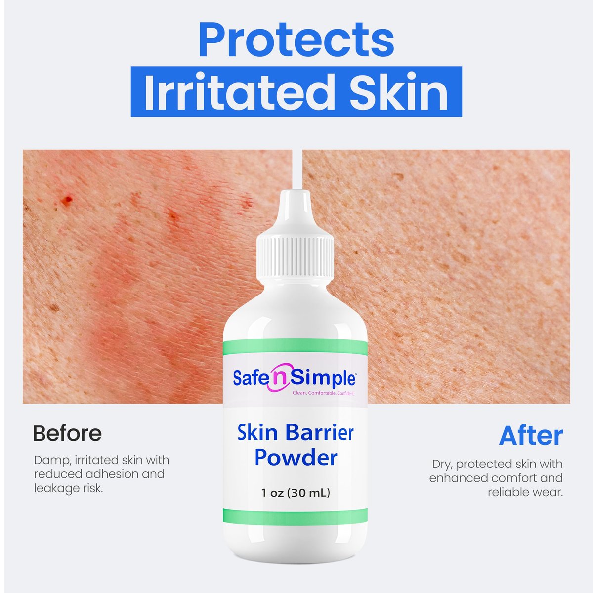 Safe n' Simple Stoma Hautschutzpuder - 28 g - Medizinischer Schutzpuder für Stoma - Haftpuder für Stomaversorgung