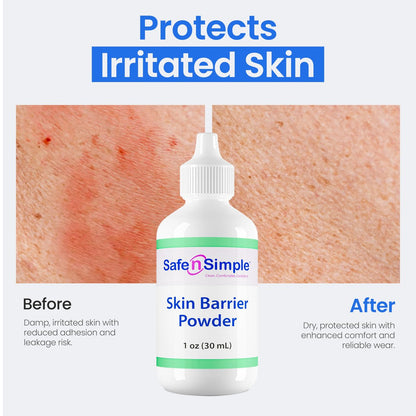 Safe n' Simple Stoma Hautschutzpuder - 28 g - Medizinischer Schutzpuder für Stoma - Haftpuder für Stomaversorgung