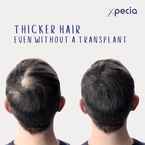 XPECIA Anti-Haarausfall DHT-Blocker für Männer – Neue Haarwuchs-Formel 60 Tabletten