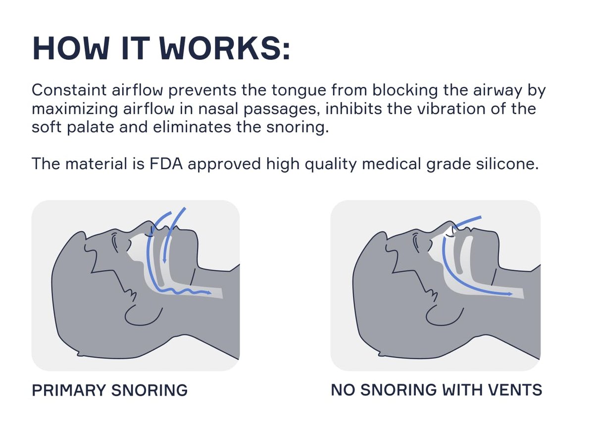 Snore Bastion Nasaldilatatoren fürs Schlafen - 4 Stück X-Large (XL) Weiche Silikon Nasenkegel - Nasenöffner - Nasenerweiterer zum Atmen - Nasenlöcher - Anti-Schnarch-Geräte