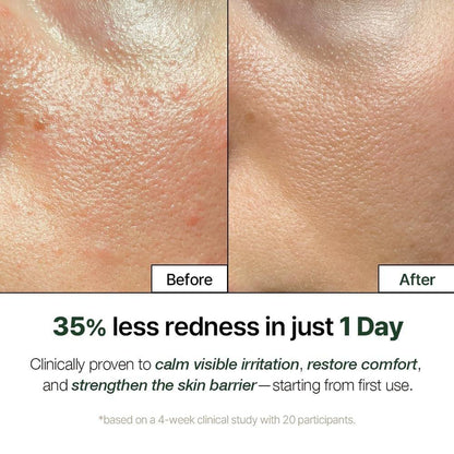 NATURAL DERMA PROJECT NDP Cica Cream - Gel-Gesichtsfeuchtigkeitscreme gegen Sonnenbrand, leichte koreanische Feuchtigkeitscreme für empfindliche Haut, Centella Asiatica, feuchtigkeitsspendend, beruhigend, lindernd (1,7 Fl Oz / 50 ml)