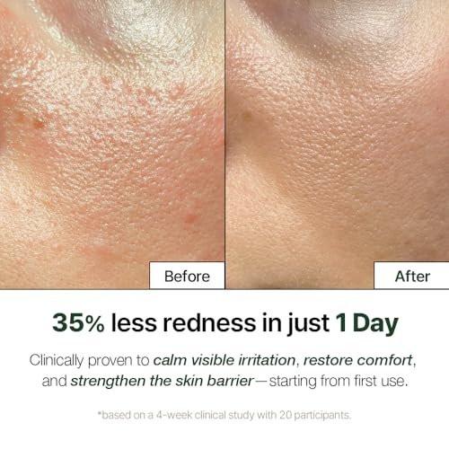 NATURAL DERMA PROJECT NDP Cica Cream - Gel-Gesichtsfeuchtigkeitscreme gegen Sonnenbrand, leichte koreanische Feuchtigkeitscreme für empfindliche Haut, Centella Asiatica, feuchtigkeitsspendend, beruhigend, lindernd (1,7 Fl Oz / 50 ml)