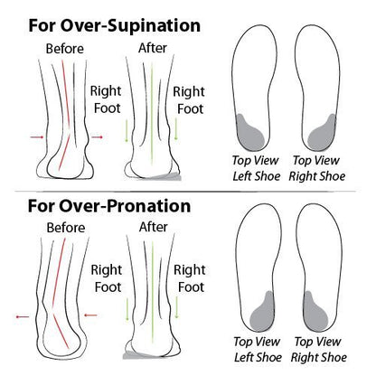 Fersenkeil für Überpronation und Übersupination – Wiederverwendbare selbstklebende Gel-Einlage