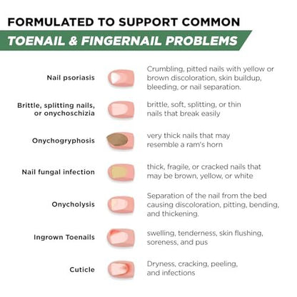Foot Cure Zehennagelpilz Behandlung Extra Stärke – Fußpilz Behandlung für Zehennägel, Restorative Nagelreparatur für beschädigte Nägel, Nagelweichmacher mit Teebaumöl & Oreganoöl – Hergestellt in den USA