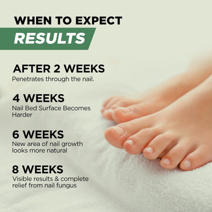 Foot Cure Zehennagelpilz Behandlung Extra Stärke – Fußpilz Behandlung für Zehennägel, Restorative Nagelreparatur für beschädigte Nägel, Nagelweichmacher mit Teebaumöl & Oreganoöl – Hergestellt in den USA