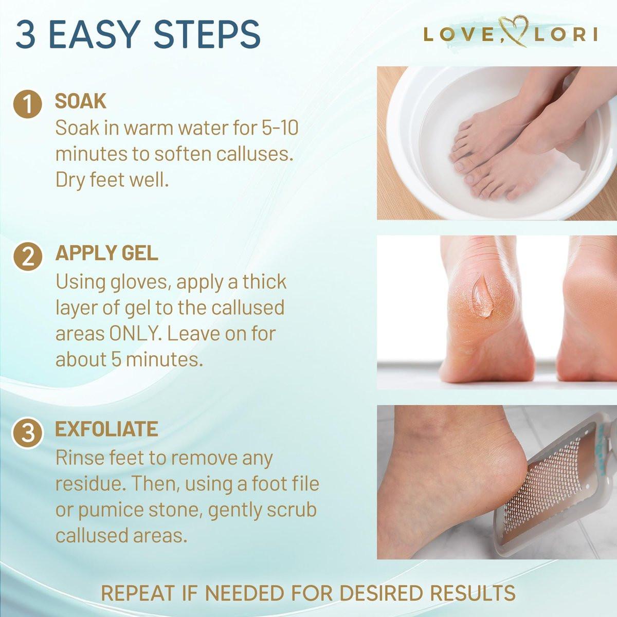 LOVE, LORI Hornhautentferner für die Füße (Extra Stärke) – Fuß-Hornhautentferner-Gel – Pediküre-Werkzeug für Fußpeeling – Fußpflege-Spa-Essentials, 177 ml