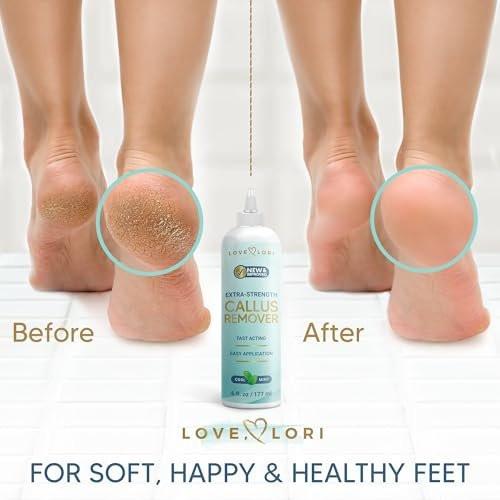 LOVE, LORI Hornhautentferner für die Füße (Extra Stärke) – Fuß-Hornhautentferner-Gel – Pediküre-Werkzeug für Fußpeeling – Fußpflege-Spa-Essentials, 177 ml