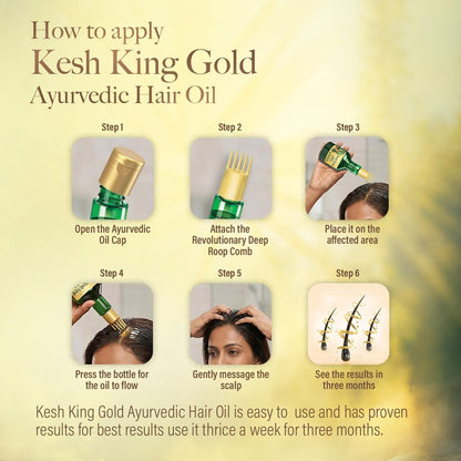 Kesh King Ayurvedisches Haaröl | Kräuteröl mit Bhringraj & Amla | Fördert Haarwachstum | Reduziert Haarausfall | Pflegt die Kopfhaut | Für langes & dickes Haar | 300 ml