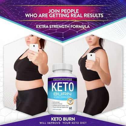 Toplux Keto Burn Kapseln – 1200 mg Ketose-Booster für natürliche Fettverbrennung & Gewichtsverlust – 60 Kapseln für Männer und Frauen