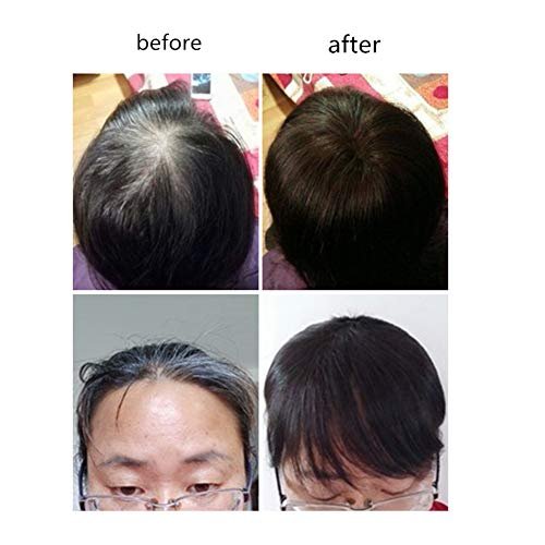 LXUE Echthaar Toupet mit Pony – Clip-in Haarteil für dünner werdendes Haar (25 cm, Dunkelbraun)
