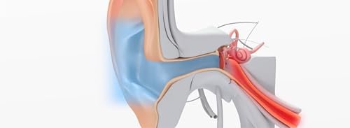 Otovent Erwachsenen Autoinflationsgerät - Klinisch wirksame Behandlung bei Paukenerguss (Glue Ear)