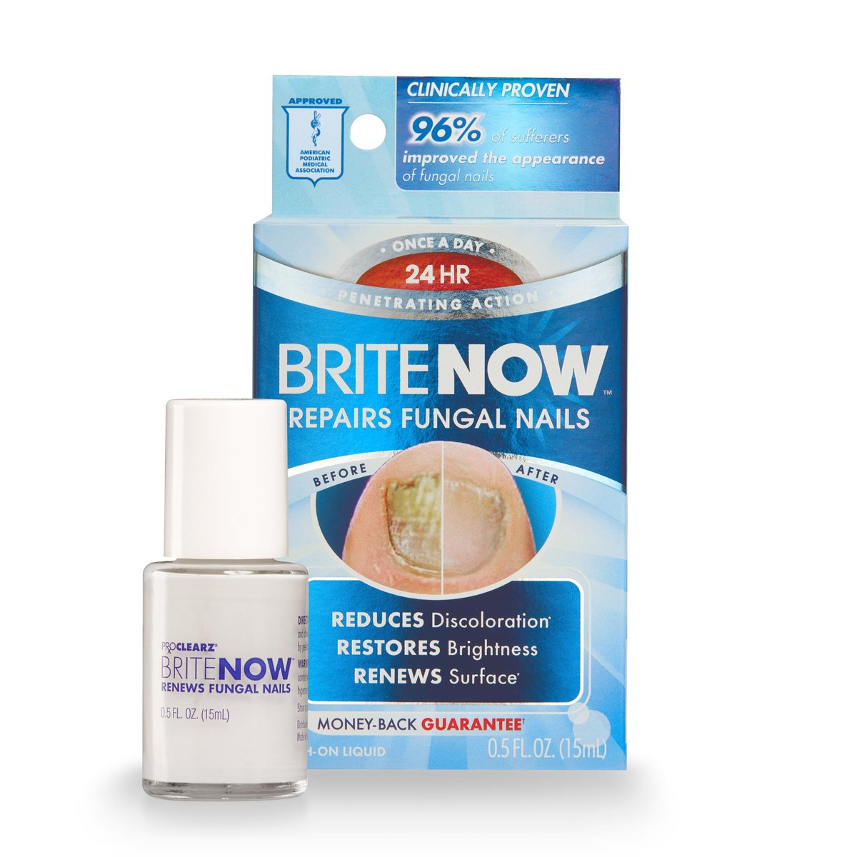 ProClearz Brite Now Nagelbehandlung – Repariert beschädigte & verfärbte Nägel mit Peel-Away-Technologie, aufhellend & glättend, 15 ml