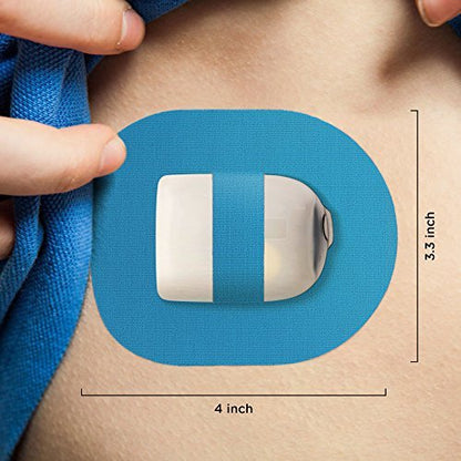 SIMPATCH Omnipod Klebepflaster mit Gurt (25er-Pack) – Wasserdichte CGM-Klebefolie (Blau)