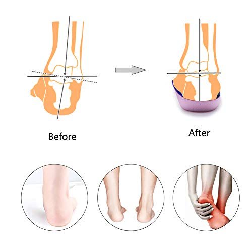 PCSsole 3/4 Ortho-Einlegesohlen mit hohem Fußgewölbe für Plantarfasziitis, Plattfüße, Überpronation und Fersensporn – Schmerzlinderung (Lila, Herren 6,5-8,5 / Damen 7,5-9,5)