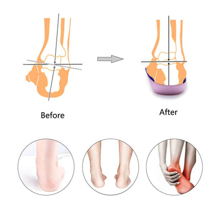 PCSsole 3/4 Ortho-Einlegesohlen mit hohem Fußgewölbe für Plantarfasziitis, Plattfüße, Überpronation und Fersensporn – Schmerzlinderung (Lila, Herren 6,5-8,5 / Damen 7,5-9,5)