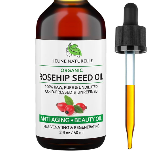Jeune Naturelle Hagebuttenöl – Reines, natives, kaltgepresstes Öl aus ganzen Beeren (Fruchtfleisch & Kerne), natürliche tiefe Orange-Tönung für intensive Hautreparatur – Unverdünntes Bio-Hagebuttenkernöl, 60 ml