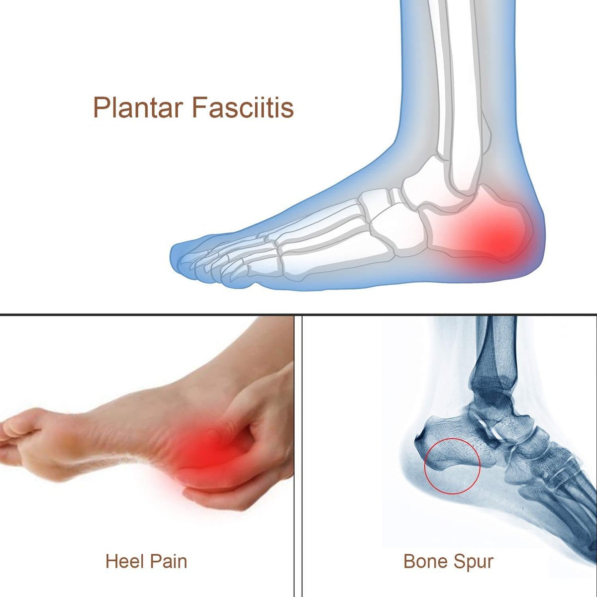 LOVE MEI Silikon-Fersengel-Einlagen – Stoßdämpfende Fersenpolster bei Plantarfasziitis, Fersenschmerzen, Knochensporn & Achillessehnenentzündung – 2 Paar (4 Stück), Transparent, Klein