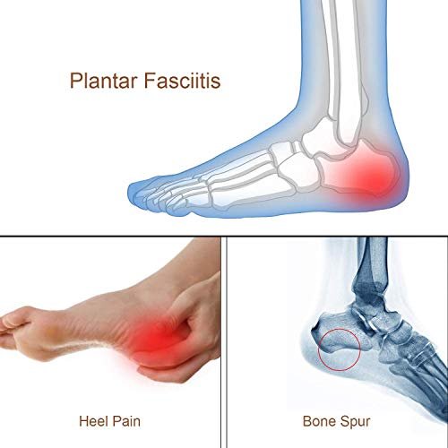LOVE MEI Silikon-Fersengel-Einlagen – Stoßdämpfende Fersenpolster bei Plantarfasziitis, Fersenschmerzen, Knochensporn & Achillessehnenentzündung – 2 Paar (4 Stück), Transparent, Klein