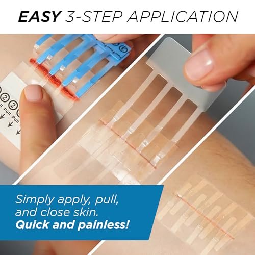 Clozex Notfall-Wundversorgungsset – Wunden ohne Nähte verschließen, Hautverschlussgerät für Wunden bis 3,8 cm Länge. Komplettes Set zur Reinigung, Schließung und Abdeckung von Wunden