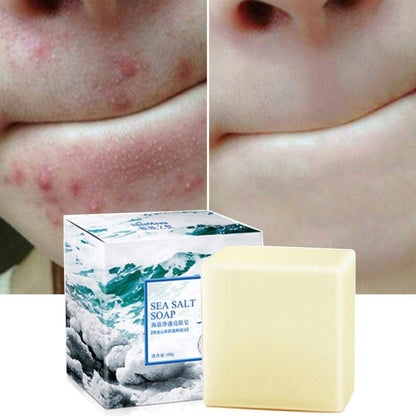 Natürliche Ziegenmilchseife mit Meersalz – für Gesicht, trockene und fettige Haut, gegen Akne und Cellulite (100 g)