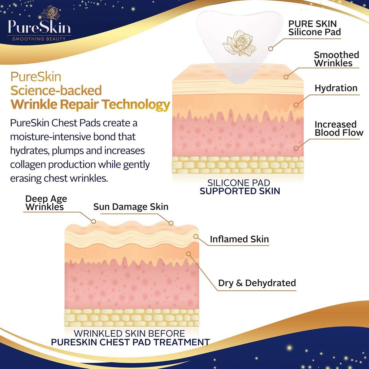 PureSkin Brustfaltenschutz-Pads – 4er-Pack – Dekolleté Anti-Falten Pads | Silikonpflaster gegen Falten | Brustfalten durch Seitenschlaf | Silikon Brustpads