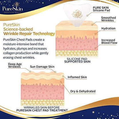 PureSkin Brustfaltenschutz-Pads – 4er-Pack – Dekolleté Anti-Falten Pads | Silikonpflaster gegen Falten | Brustfalten durch Seitenschlaf | Silikon Brustpads