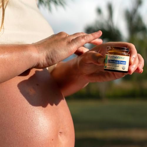 Motherlove C-Section Creme (30ml) – Bio-Kräuter-Narbencreme zur Pflege nach Kaiserschnitt – Lindert Beschwerden, minimiert Narbenbildung & reduziert Narbengewebe – Nicht-GMO, tierversuchsfrei