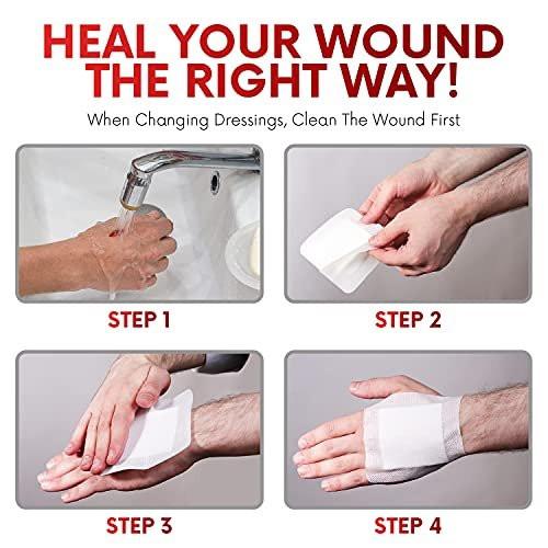 HEALQU Bordered Gauze Island Dressing – 50 Stück, 2" x 2" sterile, einzeln verpackte Gaze-Pads mit wasserabweisender, nicht gewebter Rückseite – weiche und atmungsaktive Wundauflage für Erste Hilfe und medizinische Anwendungen